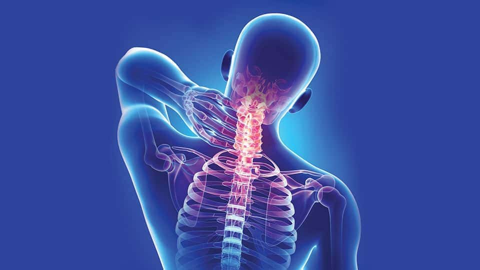 Cervical